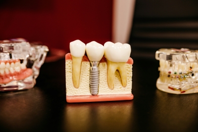 Dentist Suicides