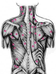 Hybrid Fibromyalgia Fix in HBI Hidden Causes Back Pain Therapy & Dr. Greg Fors’ Well Researched Chronic Pain Syndrome Solutions