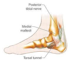 The Tarsal Tunel