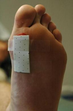 The Toe Pad